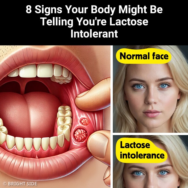 8 Signs Your Body Might Be Telling You’re Lactose Intolerant