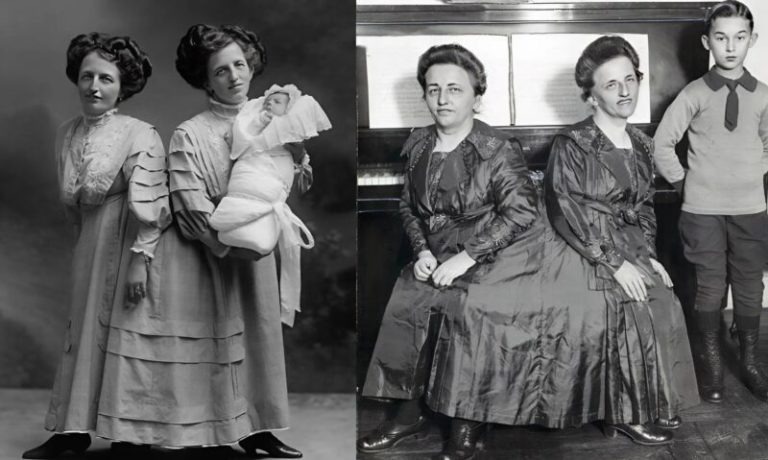 ST1. The Incredible Story of the Siamese Twins: One Fell in Love, Had a Baby — and Both Became Mothers…