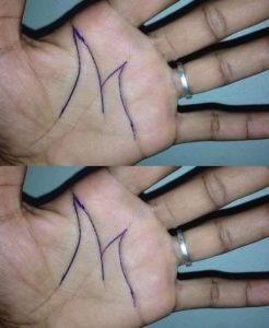 HT15. Why some people have an ‘M’ on their palm