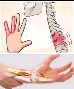 HT15. Numb Hands: Is It Normal or a Sign of a Problem?