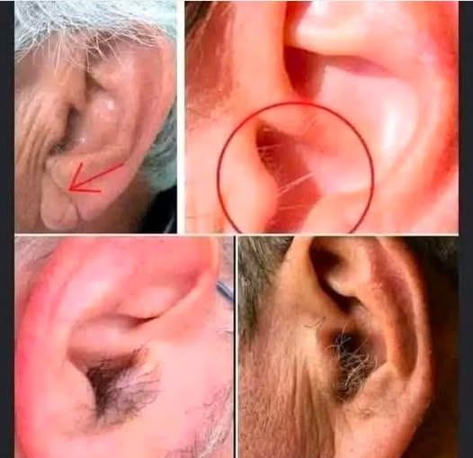 HT3. Did you know that if your ear hairs grow, it is because your body is