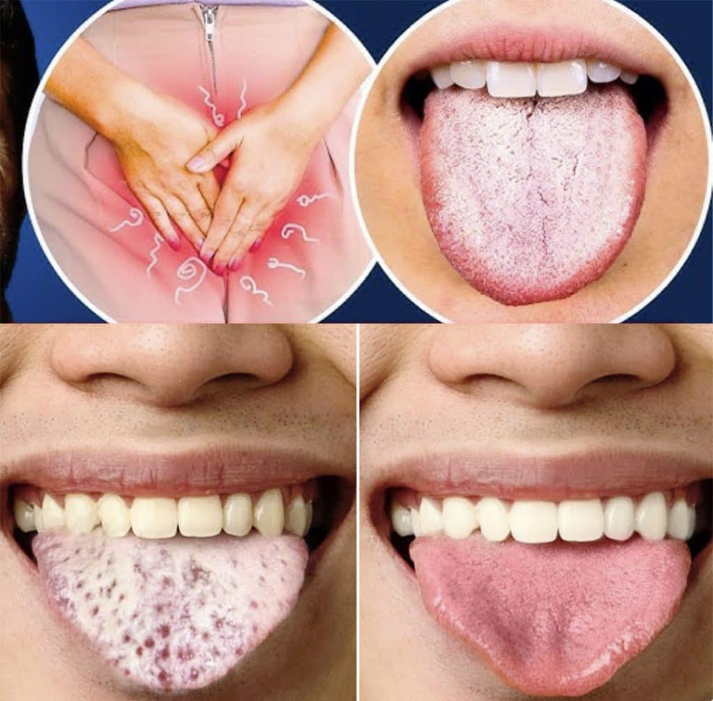 HT16. What Your Tongue Can Tell You About Your Health: 4 Symptoms You Shouldn’t Ignore