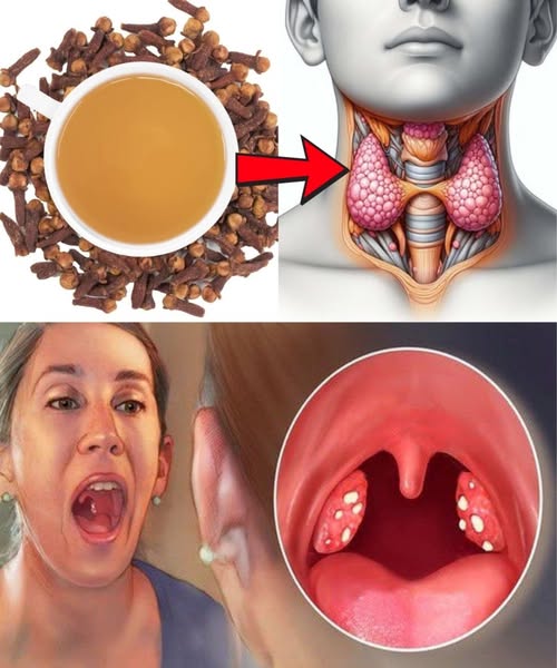 HT13. Got a Sore Throat? Try This Tiny Spice That Works Like Nature’s Antibiotic