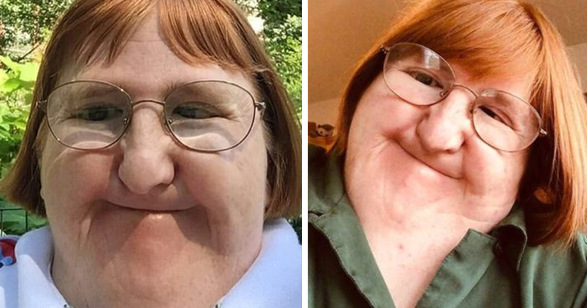 SB. Woman told she’s ‘too ugly’ for selfies uploads a selfie a day for a year, refuses to be bullied by trolls