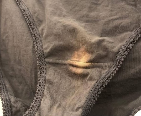 HT15. If You Find a “Bleach” Patch on Your Underwear, Here’s What It Means