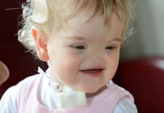 HT1. Tessa Evans’ Rare Condition: Overcoming Challenges