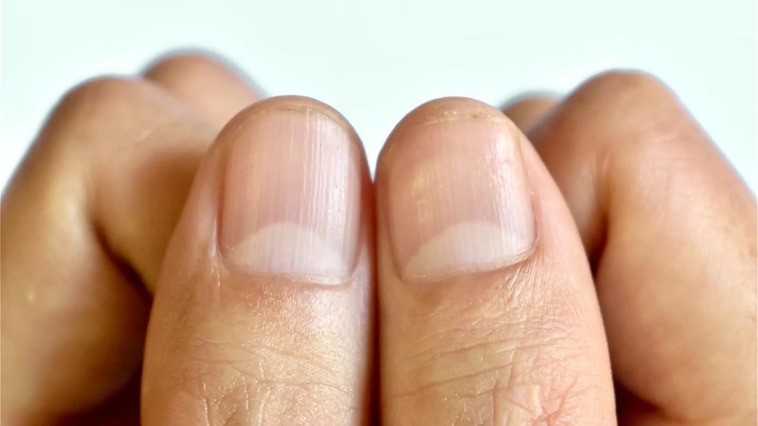 HT7. What does the half moon at the base of the nails mean?