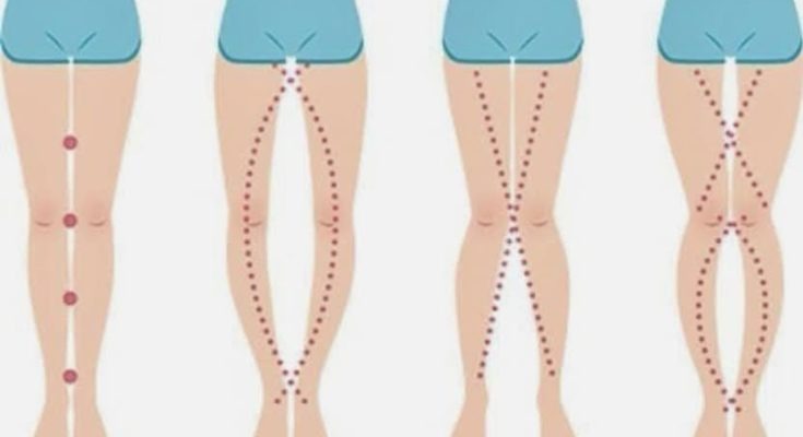 HT14. THE LEGS OF A WOMAN CAN SAY AS IT IS THEIR V*GIN
