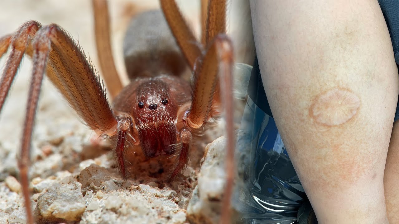 HT1. Brown Recluse Spider: What You Need to Know About This Mysterious Yet Potentially Harmful Arachnid