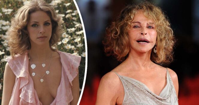 SB. This beloved Hollywood star disappeared after a tragic accident left her scarred for life