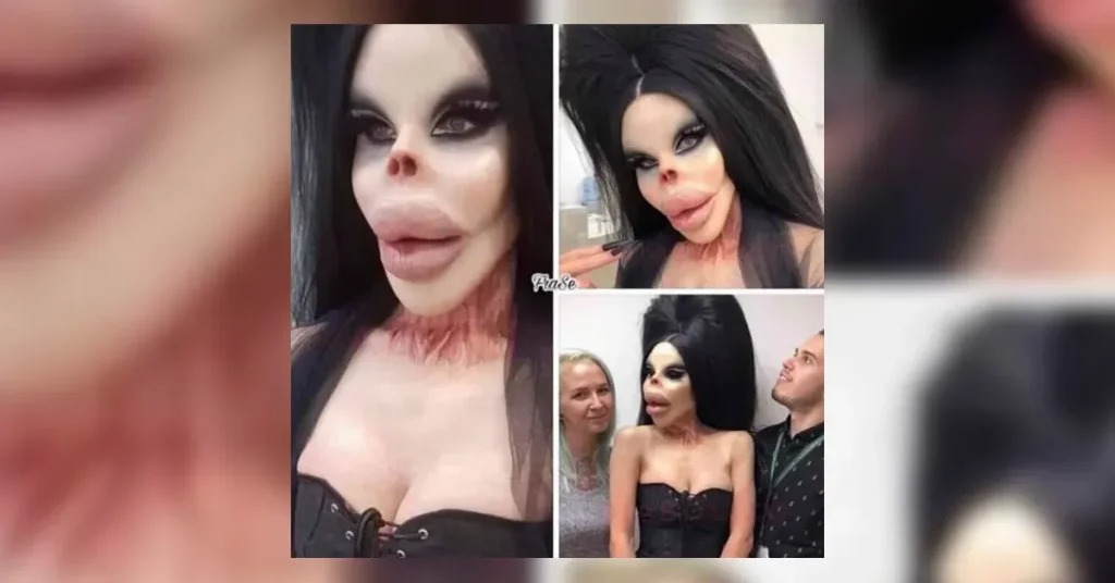 HT15. Is This a 68-Year-Old Human ‘Barbie Doll’ After Botched Plastic Surgeries? – Improve your life