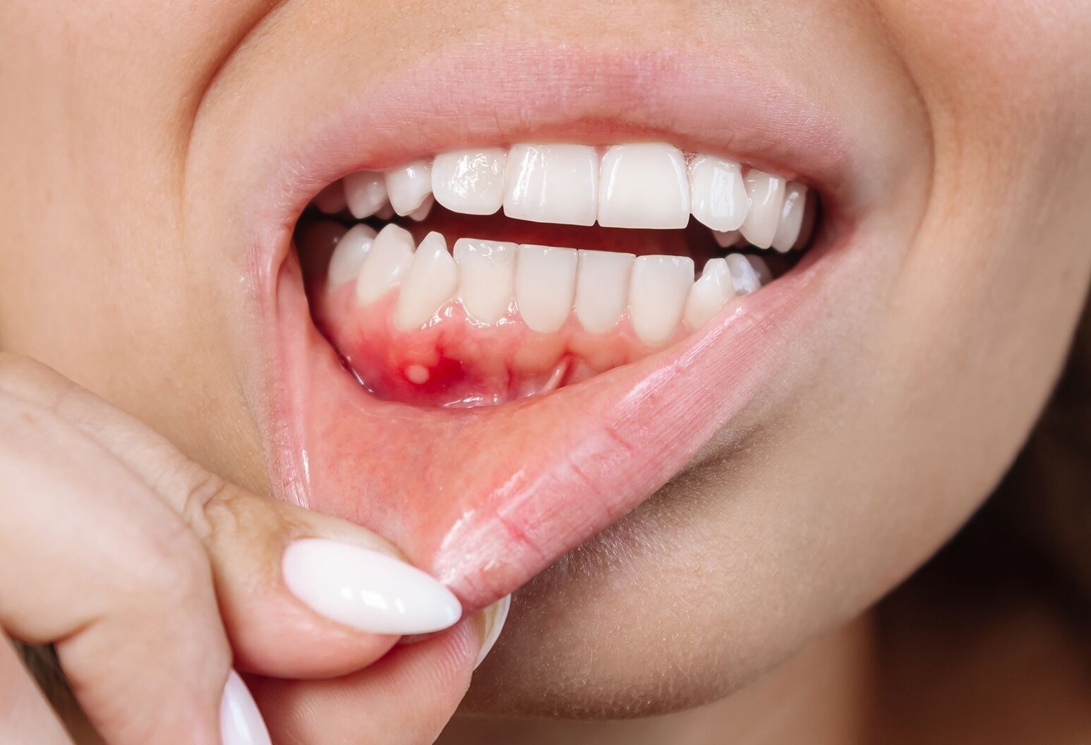 HT1. Don’t Underestimate It: Recognizing the Early Signs of Oral Can…