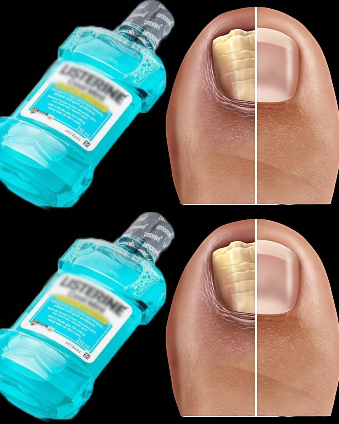 HT14. Say Goodbye to Nail Fungus with This Simple Home Remedy