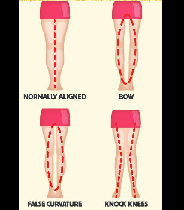 HT1. The separation between a woman’s legs means that she is… See more