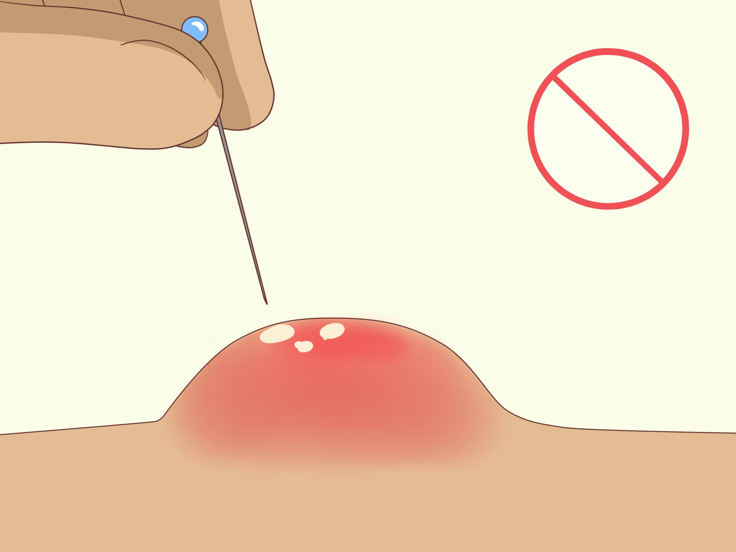 HT16. These are the signs that it’s gro…See more