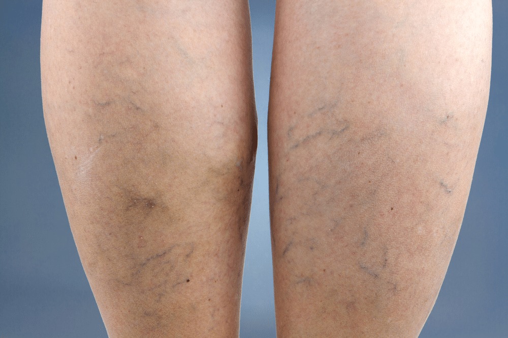 HT15. If you see these points on your feet, it means you have…