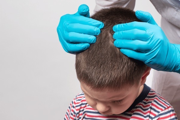 HT1. What to Do When Scalp Bumps Appear on Your Child: A Guide for Concerned Parents