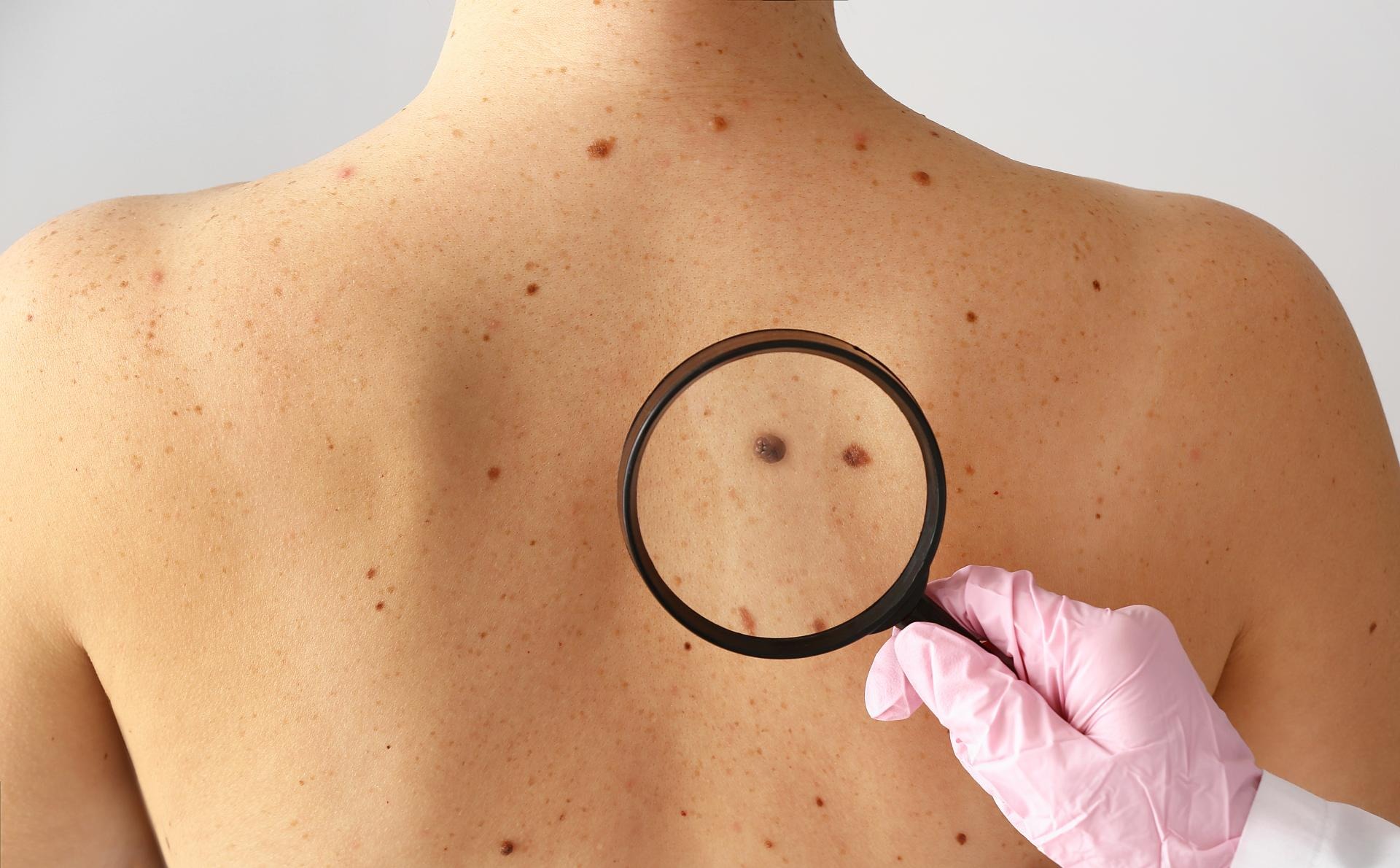 HT1. These are the signs that it’s gro…see more