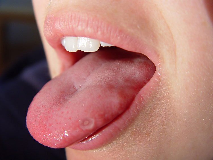 HT16. These are the consequences of eating cr… See more