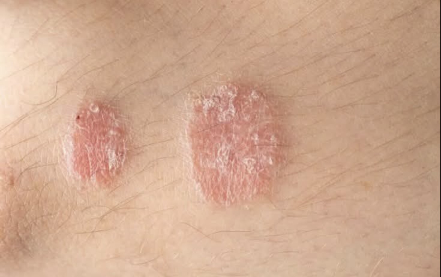 HT7. Warning signs you should never ignore on your skin