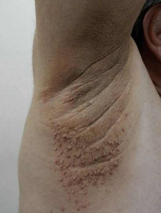 HT15. These are the first symptoms of cr…See more