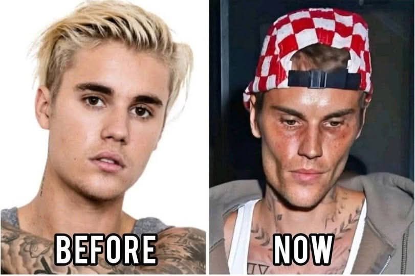 HT10. Justin Bieber admits that he tested positive for…See More