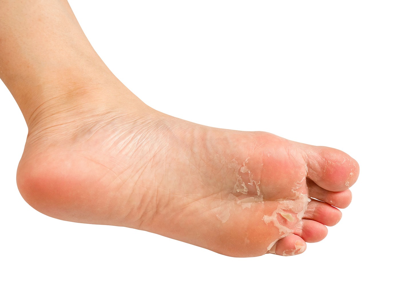 HT1. These are the signs that it’s gro…see moree