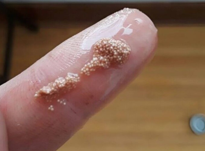 HT16. I Found Slimy Lumps in an Egg and Thought They Were Insect Eggs — Here’s What I Discovered