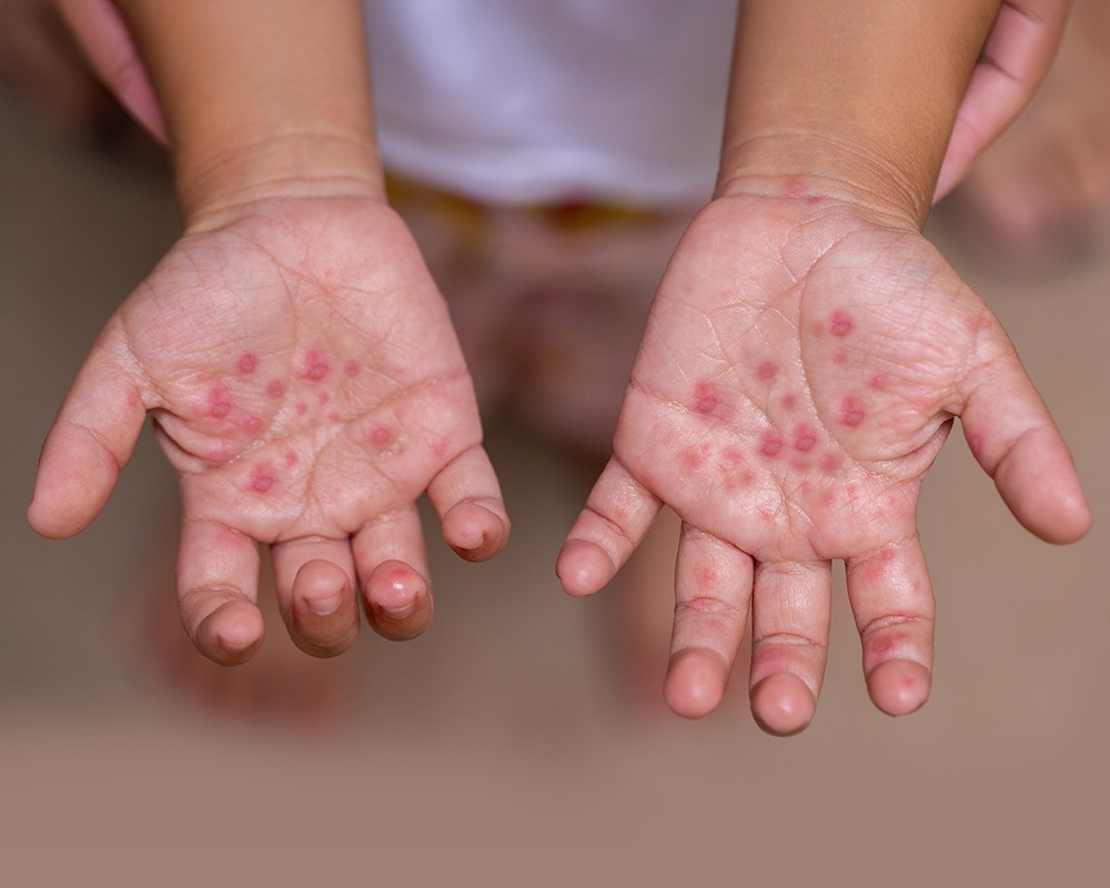 HT16. Symptoms You Should Never Ignore: What They Might Be Telling You