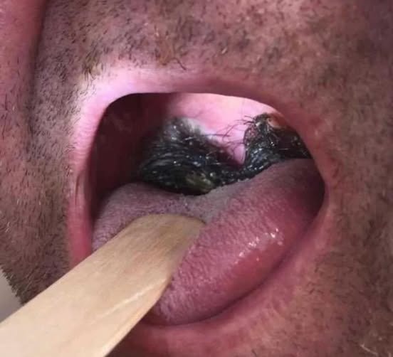 HT1. These are the consequences of sleeping with…see more