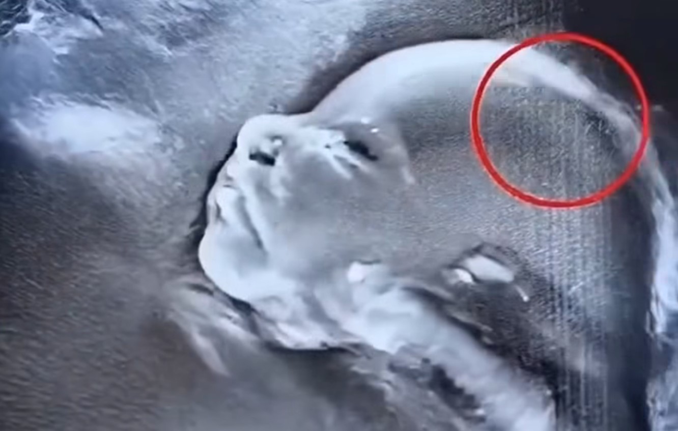 HT15. Doctors couldn’t believe what they saw during the ultrasound