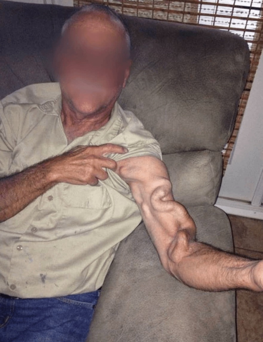HT1. A Man Goes to Stretch and Ends Up Feeling a Sharp Pain in His Arm, It Was a Case That Shocked Everyone