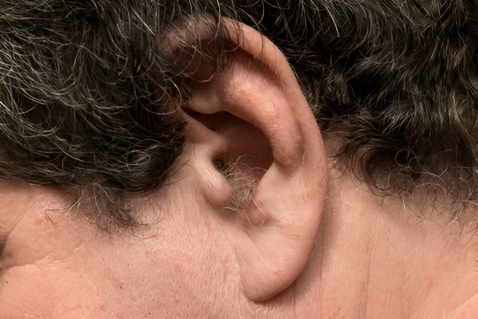 HT10. If you have hair growing in your ears, the real reason is… See more