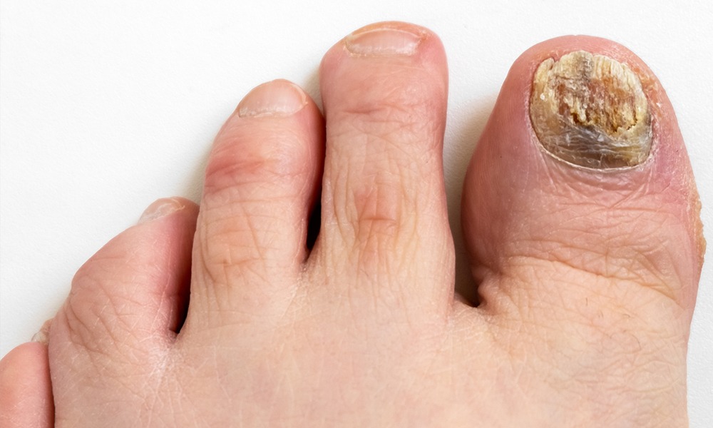 HT10. Signs on your FEET that indicate you are cr…See more