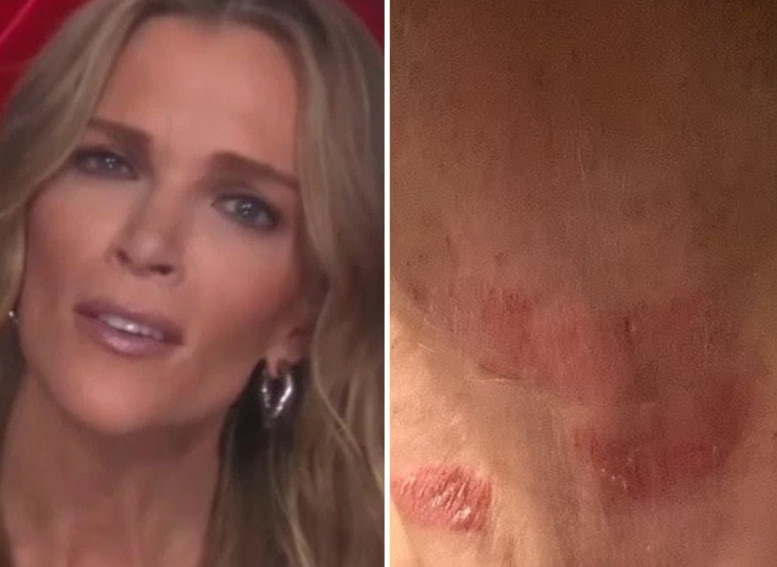 HT10. 4. Megyn Kelly Hospitalized in Critical Condition… See more