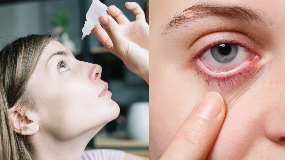 ST10. Understanding Eye Infections: Causes, Symptoms, and Effective Treatments