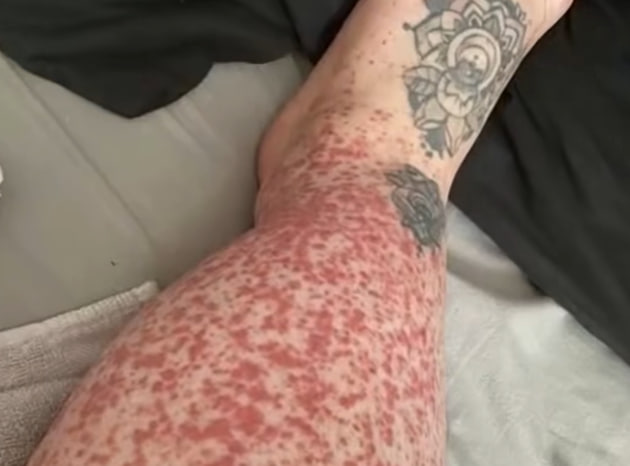 HT7. These are the consequences of sleeping with the…