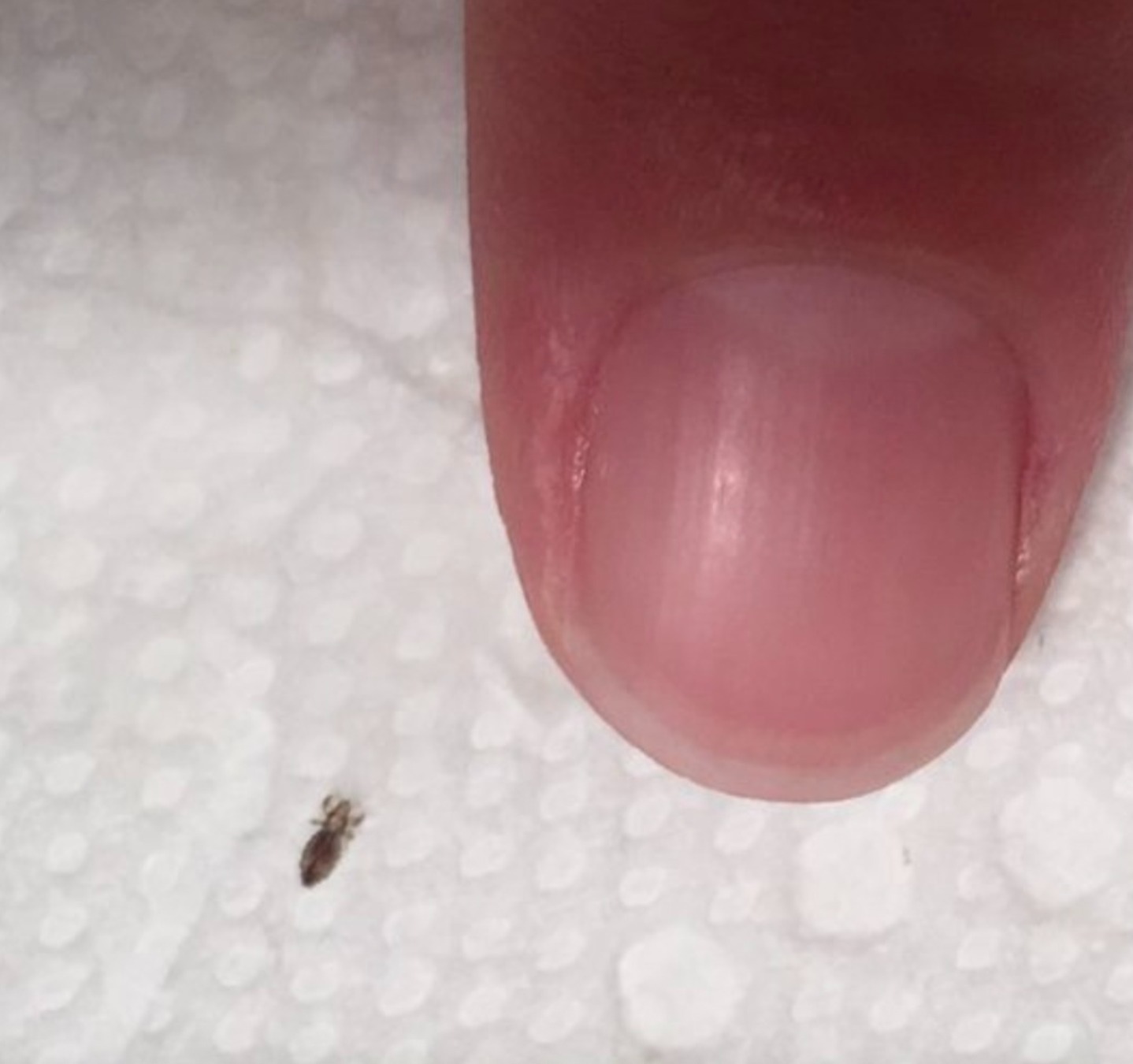 HT10. If you find this bug in your hair, you must read this