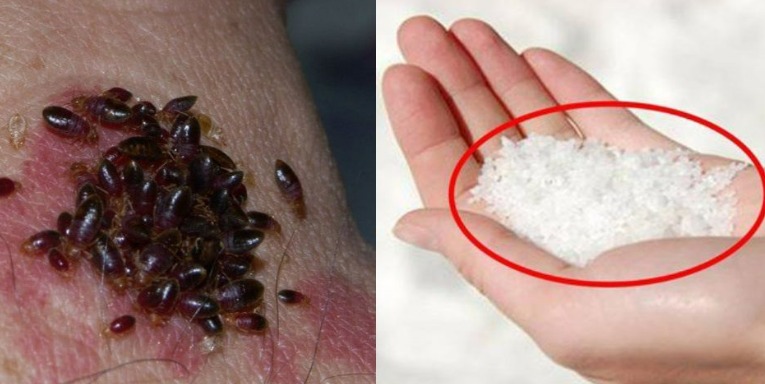 HT10. Bedbugs Will Disappear From Your Garden In Minutes By Doing This