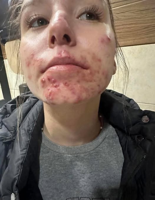 HT6. These are the consequences of sleeping with a… See more here