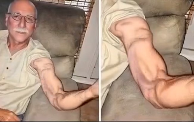 HT10. Man Goes to Stretch and Ends Up Feeling a Sharp Pain in His Arm, It Was a Case That Shocked Everyone