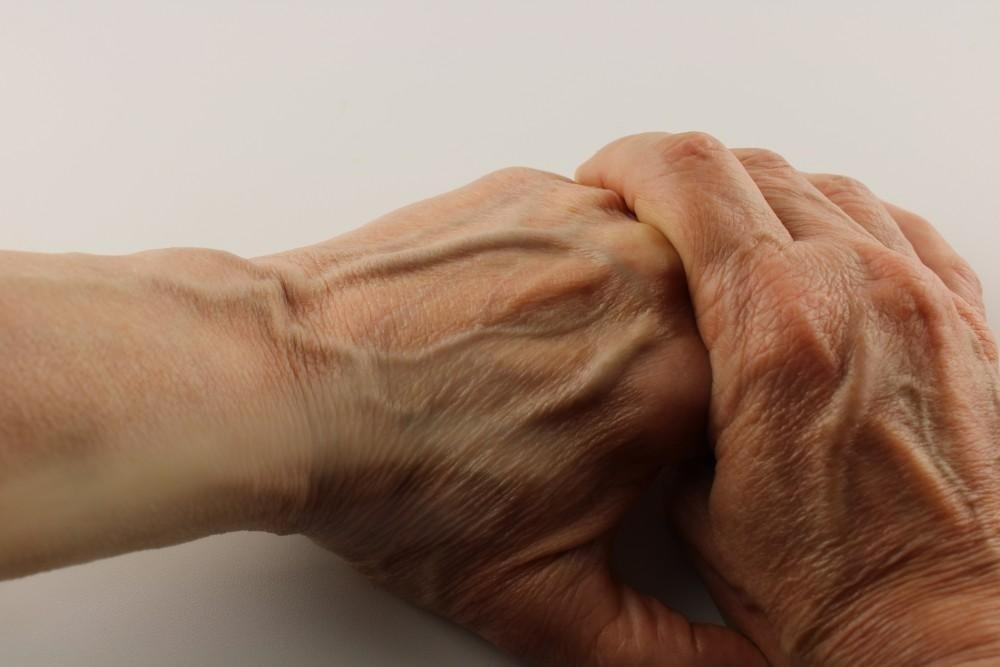 HT14. If your veins are visible in your body, it is a signal of ca… See more