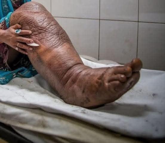 HT14. These are the consequences of sleeping with a… See more