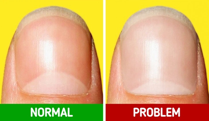 ST6. 10 Signals Your Body Sends to Tell You Something Is Wrong