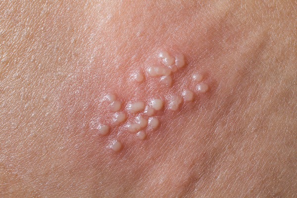 HT10. These are the consequences of sleeping co… See more..