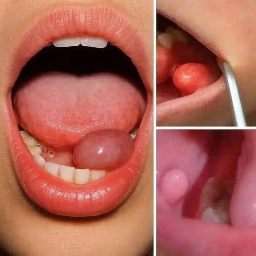 HT14. These are the first symptoms of a…see more
