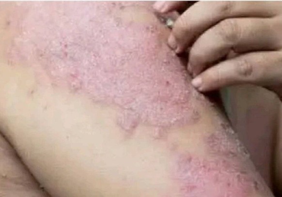 HT6. These are the consequences of sleeping with the…