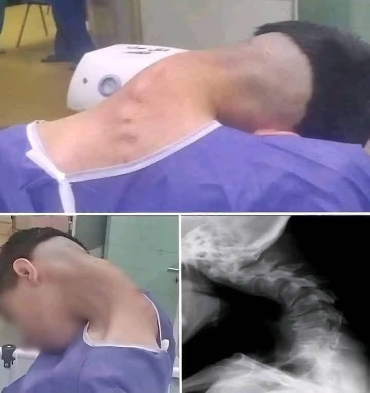 HT15. Young man hospitalized because he dropped his ca…See more