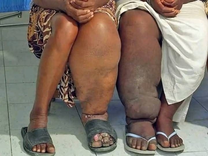 HT10. These are the consequences of sleeping with a… See more