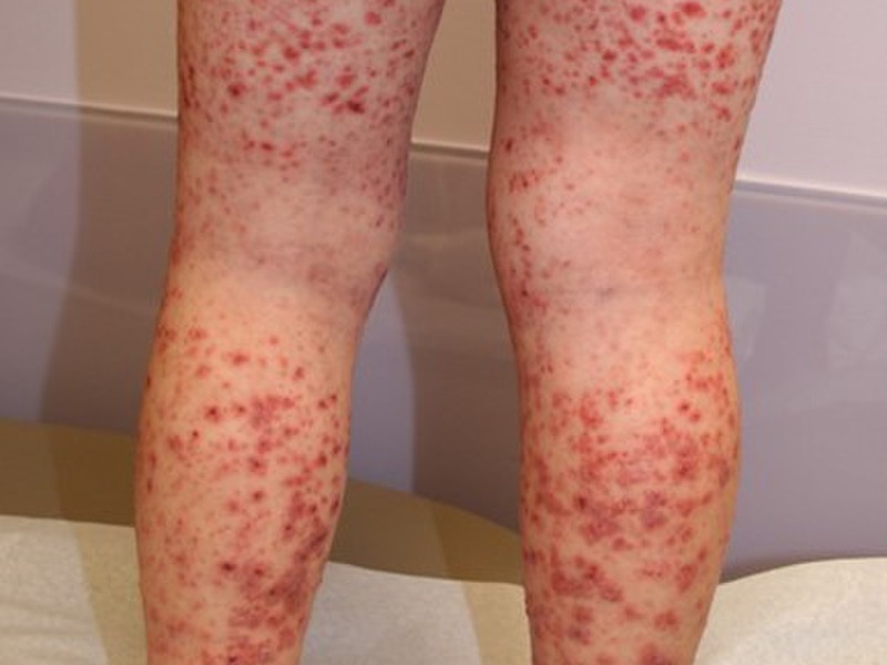 HT10. These are the consequences of sleeping with…See more